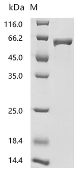 Recombinant Human Nucleosome assembly protein 1-like 1 (NAP1L1)