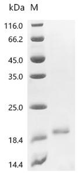 Recombinant Fusarium oxysporum f. sp. lycopersici ribonuclease T1