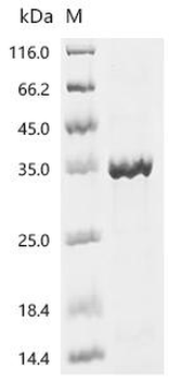Recombinant Human Orexin receptor type 2 (HCRTR2), partial