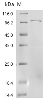 Recombinant Human Flavin-containing monooxygenase 5 (FMO5)