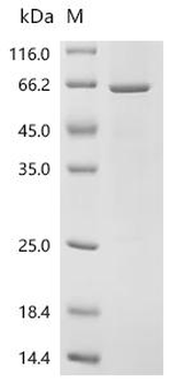 Recombinant Human ATP-dependent RNA helicase DDX39A (DDX39A)