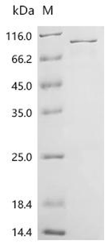 Recombinant Human Disabled homolog 1 (DAB1)