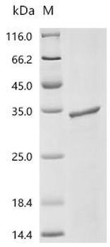 Recombinant Human Acetylcholine receptor subunit epsilon (CHRNE), partial