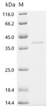 Recombinant Bordetella pertussis BrkA autotransporter (brkA), partial