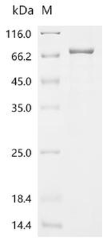 Recombinant Human BBSome complex member BBS1 (BBS1)