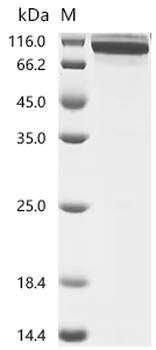 Recombinant Mouse Inactive tyrosine-protein kinase 7 (Ptk7), partial