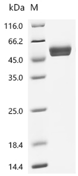 Recombinant Human Natural cytotoxicity triggering receptor 3 (NCR3), partial (Active)