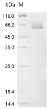 Recombinant Human Delta-like protein 4 (DLL4), partial (Active)