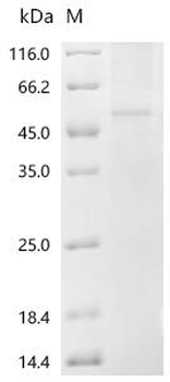 Recombinant Human Fibulin-7 (FBLN7)