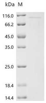 Recombinant Seoul virus Envelopment polyprotein (GP), partial
