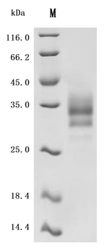 Recombinant Human Tumor necrosis factor receptor superfamily member 3 (LTBR), partial (Active)