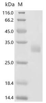 Recombinant Human Neuronal acetylcholine receptor subunit alpha-9 (CHRNA9), partial
