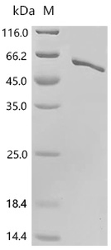 Recombinant Chicken Ovalbumin (SERPINB14)