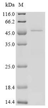 Recombinant Human Transforming growth factor beta regulator 1 (TBRG1)