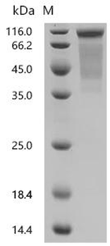 Recombinant Human Transcription factor SOX-3 (SOX3)