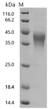 Recombinant Human Hepatitis A virus cellular receptor 2 (HAVCR2), partial