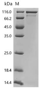 Recombinant Human GTP-binding protein GEM (GEM)