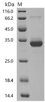 Recombinant Mouse Endothelin-2 (Edn2), partial