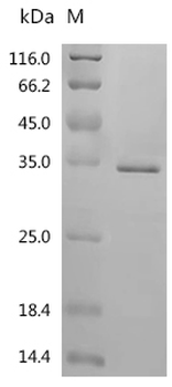 Recombinant Human E3 ubiquitin-protein ligase CHIP (STUB1)