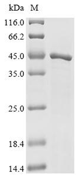 Recombinant Human E3 ubiquitin-protein ligase CHIP (STUB1)