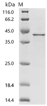 Recombinant Human Charged multivesicular body protein 4b (CHMP4B)