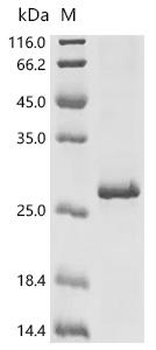 Recombinant Human Voltage-dependent T-type calcium channel subunit alpha-1I (CACNA1I), partial