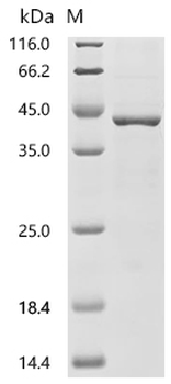 Recombinant Human Cyclin-dependent kinase 12 (CDK12), partial