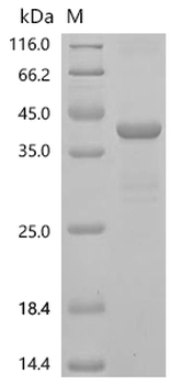 Recombinant Human Cyclin-dependent kinase 12 (CDK12), partial