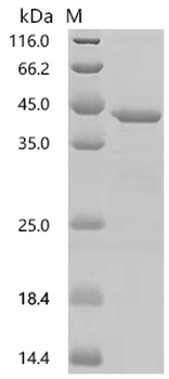 Recombinant Human Cyclin-dependent kinase 12 (CDK12), partial