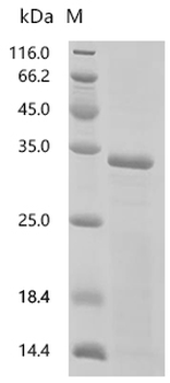 Recombinant Mouse Mucolipin-1 (Mcoln1) , partial