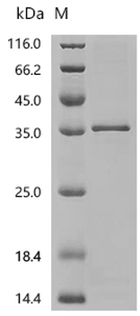 Recombinant Human F-box only protein 17 (FBXO17)
