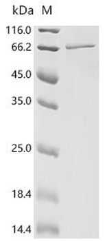 Recombinant Human DEP domain-containing protein 1B (DEPDC1B)