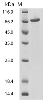 Recombinant Human Ubiquitin fusion degradation protein 1 homolog (UFD1L)