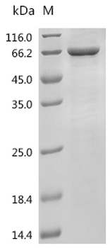 Recombinant Human Patatin-like phospholipase domain-containing protein 2 (PNPLA2)