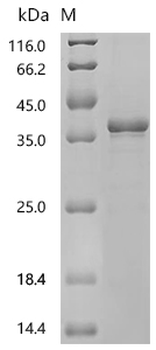 Recombinant Human Nucleoplasmin-2 (NPM2)