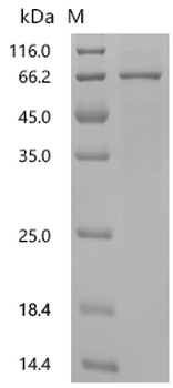 Recombinant Human DNA oxidative demethylase ALKBH2 (ALKBH2)
