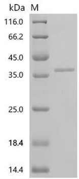 Recombinant Human Leucine-rich repeat-containing protein 9 (LRRC9), partial