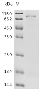 Recombinant Human Protein CBFA2T1 (RUNX1T1)