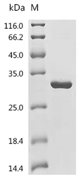 Recombinant Mouse Desert hedgehog protein (Dhh), partial