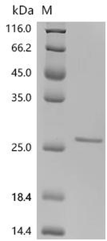Recombinant Macaca fascicularis Usherin (USH2A), partial