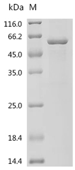 Recombinant Human UDP-glucuronosyltransferase 3A2 (UGT3A2), partial