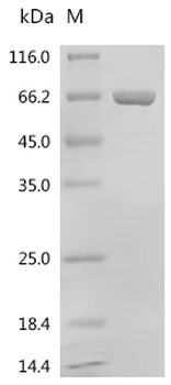 Recombinant Human Calcium-binding protein 39(CAB39)