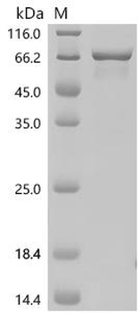 Recombinant Human Forkhead box protein C1 (FOXC1)