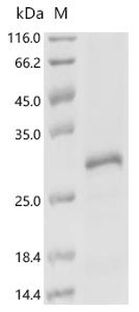 Recombinant Human Zinc finger HIT domain-containing protein 3 (ZNHIT3)