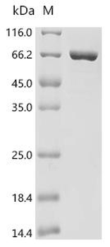 Recombinant Aquifex aeolicus Reverse gyrase 2 (rgy2), partial