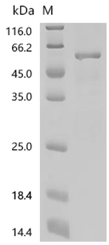 Recombinant Mouse Perilipin-2 (Plin2)