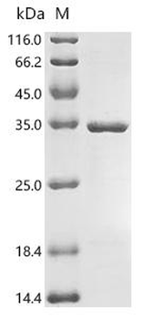 Recombinant Human cytomegalovirus Viral transcription factor IE2 (UL122), partial