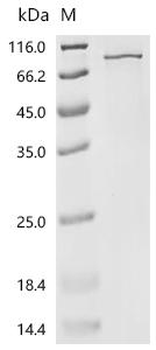 Recombinant Human Zinc finger protein 395 (ZNF395)