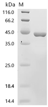 Recombinant Pig Uricase (UOX)