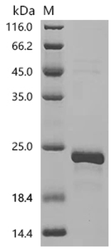 Recombinant Bovine Transthyretin (TTR)